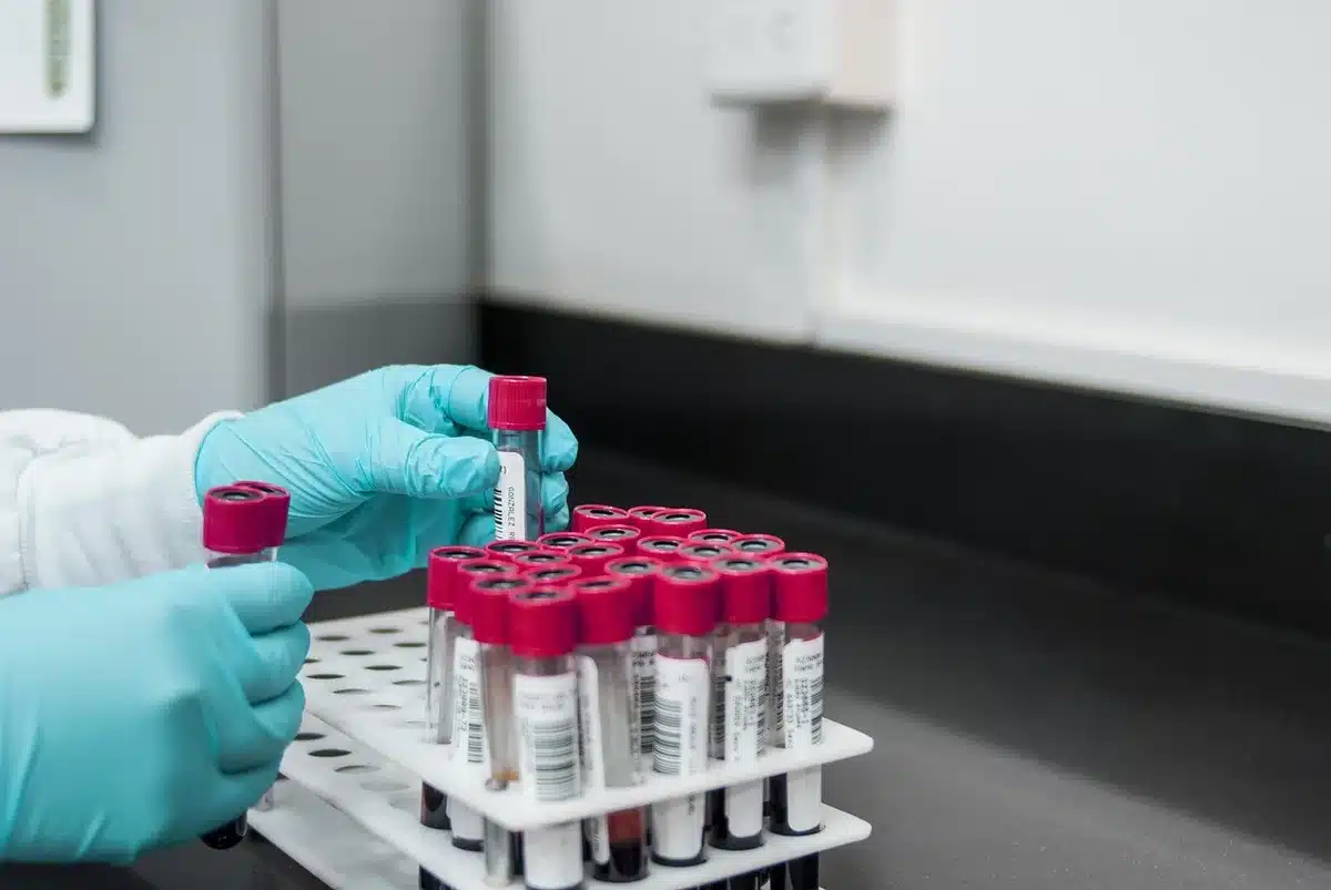 Report di test su schermo che mostra risultati e grafici delle performance del modello